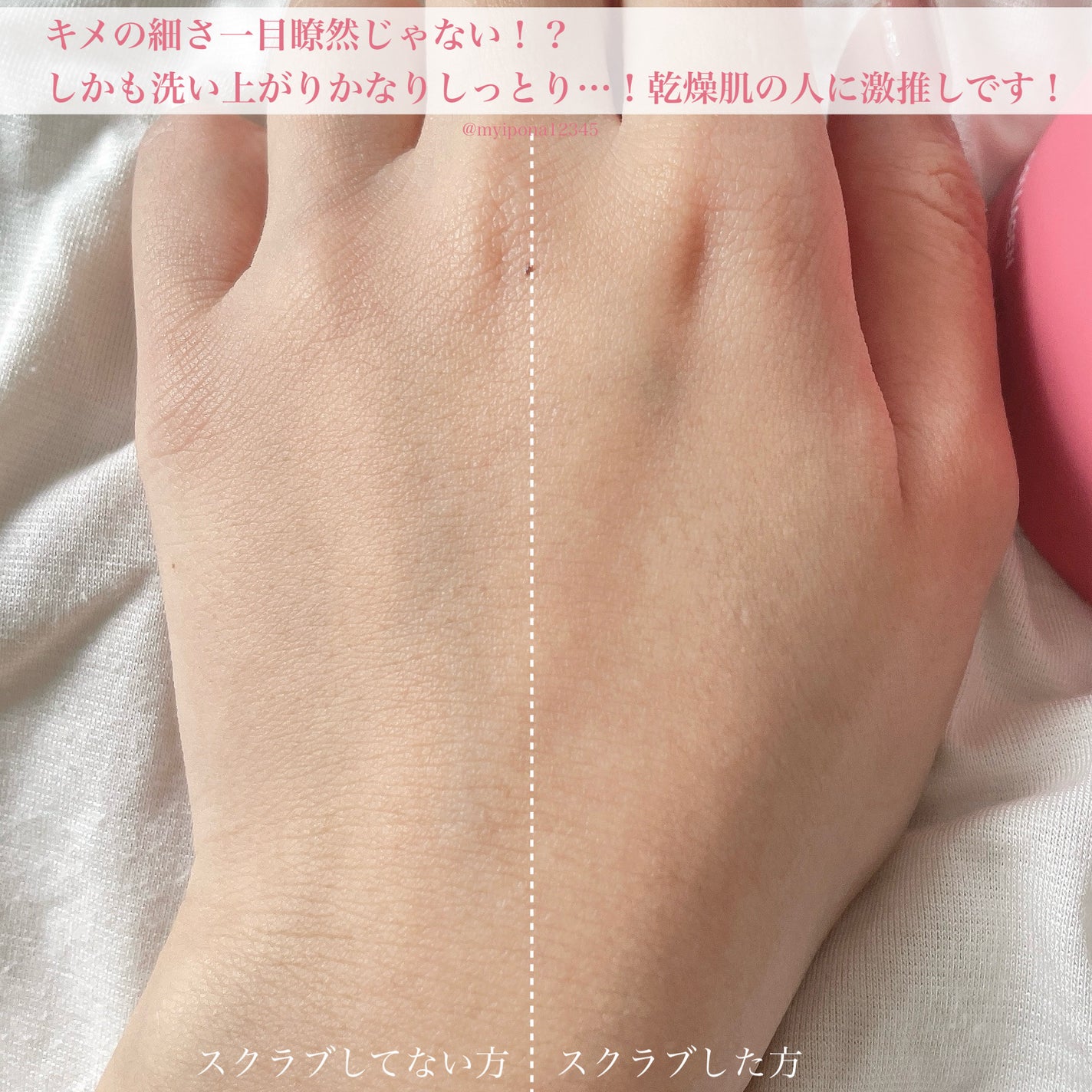 ミチャイコラーゲンスクラブ/MECHAI/ボディスクラブを使ったクチコミ(6枚目)