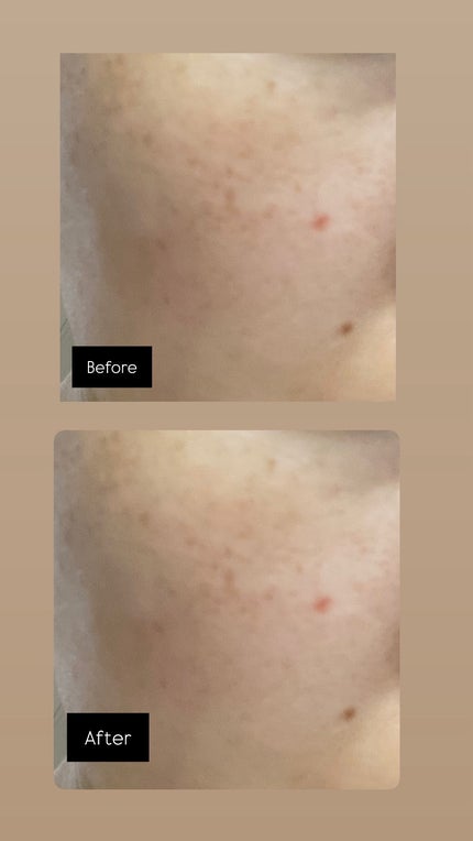 スネイルコラーゲンアクティブクリーム/It's skin/フェイスクリームを使ったクチコミ(5枚目)