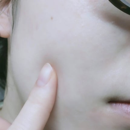 コモエース ネオ 浸透ローション/コモエース/化粧水を使ったクチコミ(10枚目)