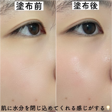 AZアゼライン酸15セラム/コスデバハ/美容液を使ったクチコミ(4枚目)