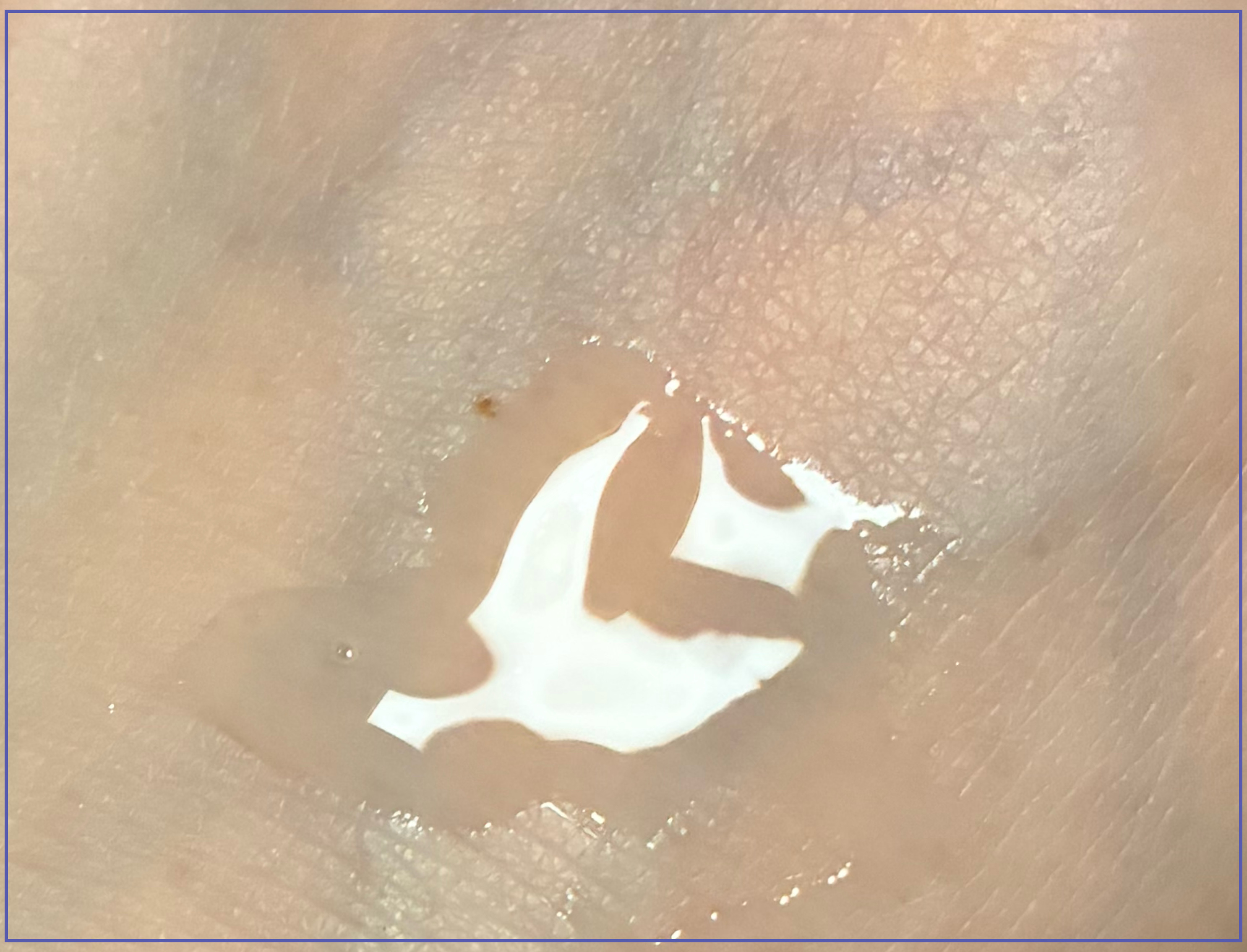 セラムヴェール ディープリペア/ONE BY KOSE/美容液を使ったクチコミ（3枚目）