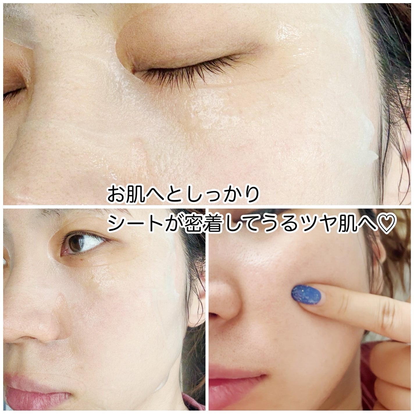 PDRNヒアルロン酸カプセル100セラムマスクパック/Anua/シートマスク・パックを使ったクチコミ(4枚目)