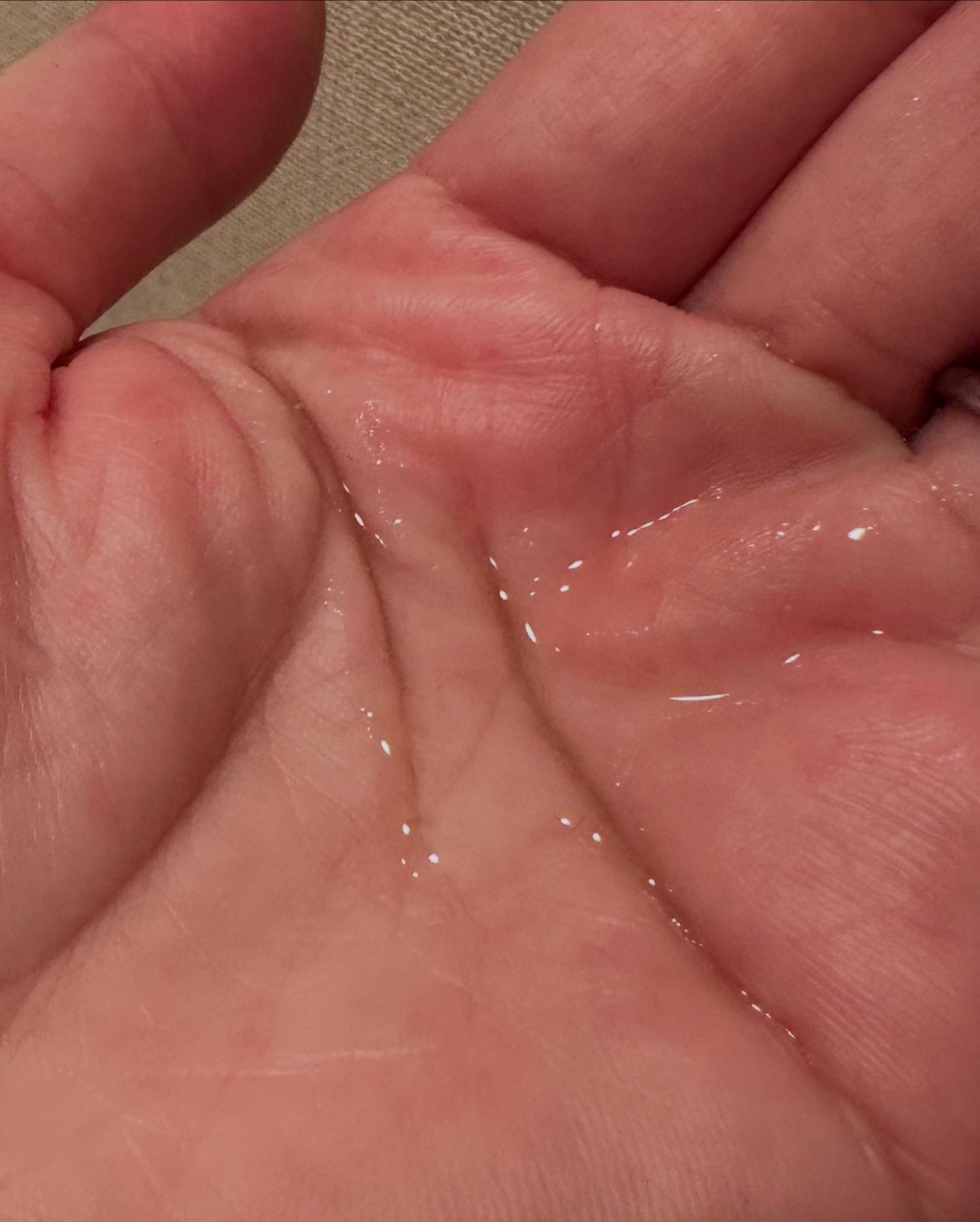 グリーンズカーミングトナー/ASNO/化粧水を使ったクチコミ（2枚目）