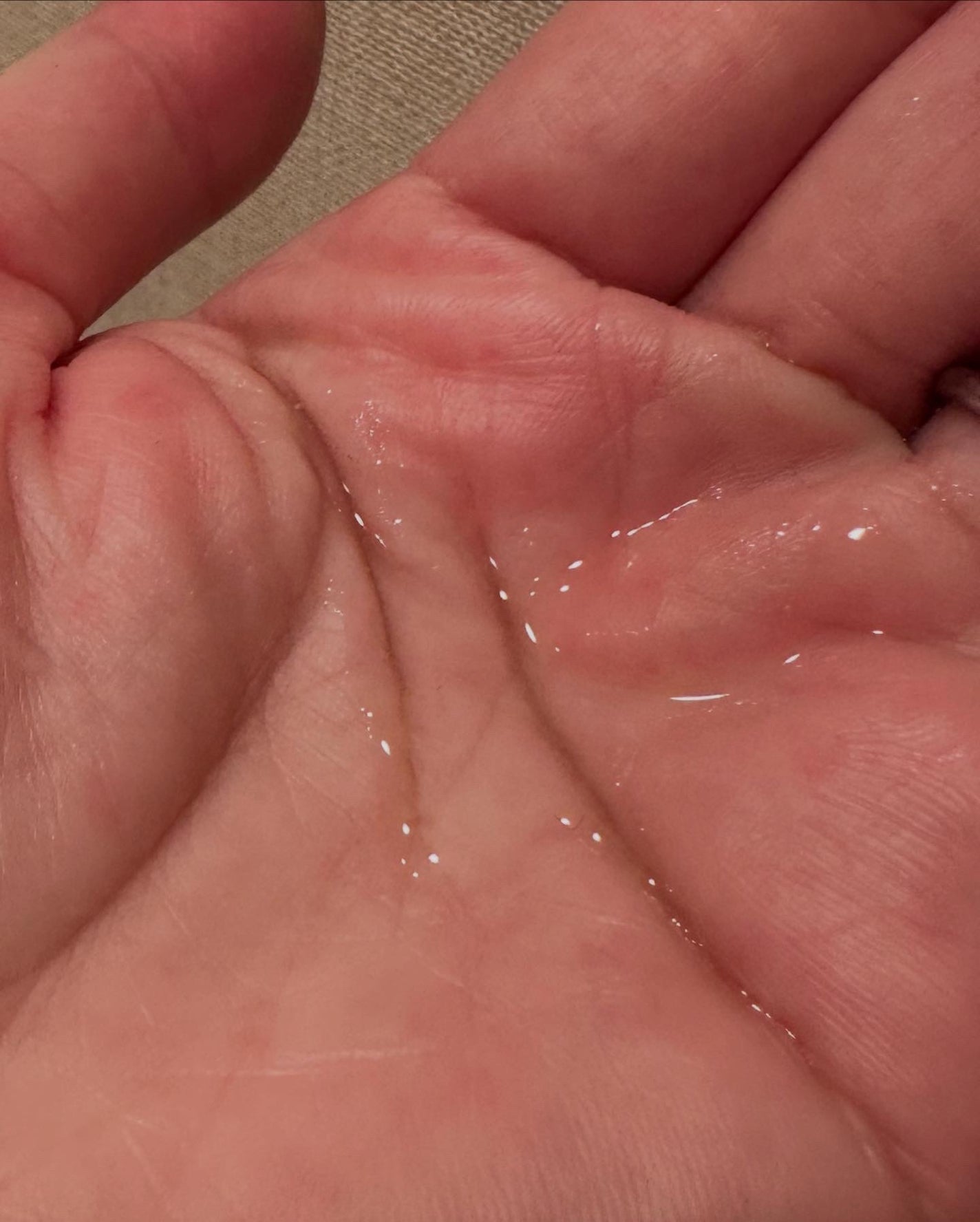 グリーンズカーミングトナー/ASNO/化粧水を使ったクチコミ(2枚目)