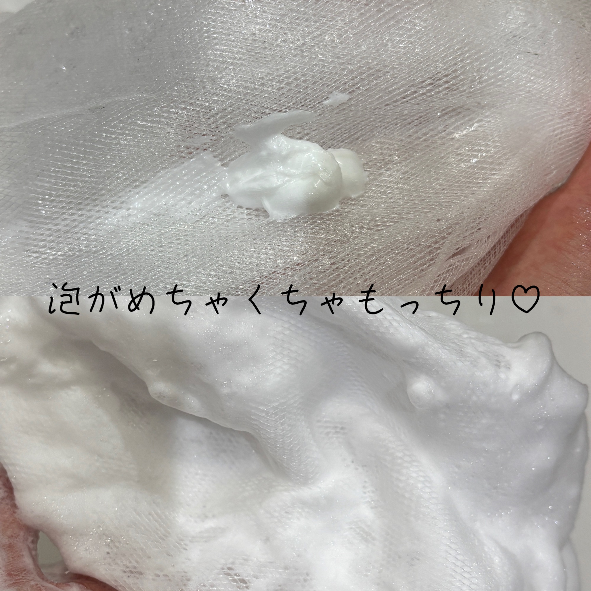 パーフェクトホイップ アクネケア 120g/SENKA（専科）/洗顔フォームを使ったクチコミ（2枚目）