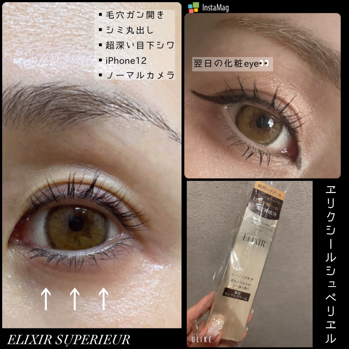 レチノパワー リンクルクリーム /エリクシール/アイケア・アイクリームを使ったクチコミ（1枚目）