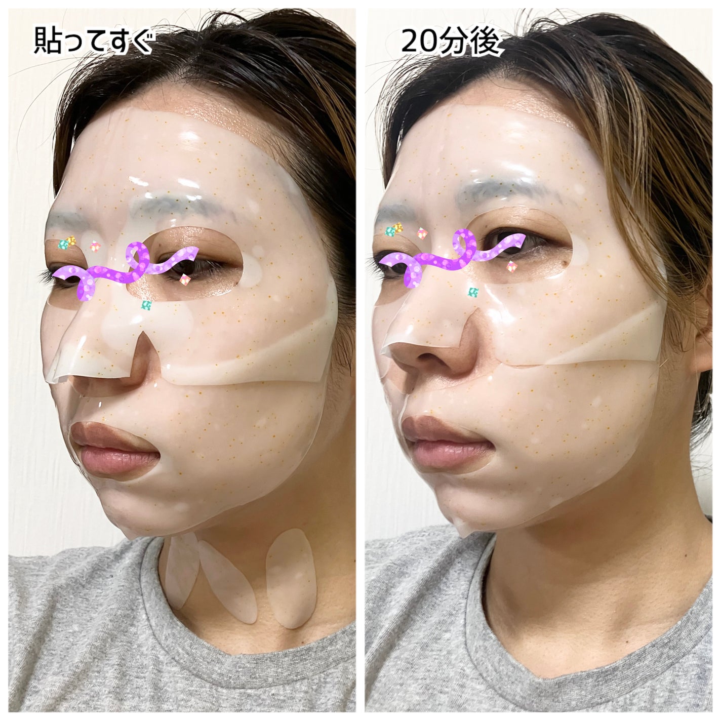 ユース ラディアンス ビタチノール セラム/primera/美容液を使ったクチコミ(5枚目)