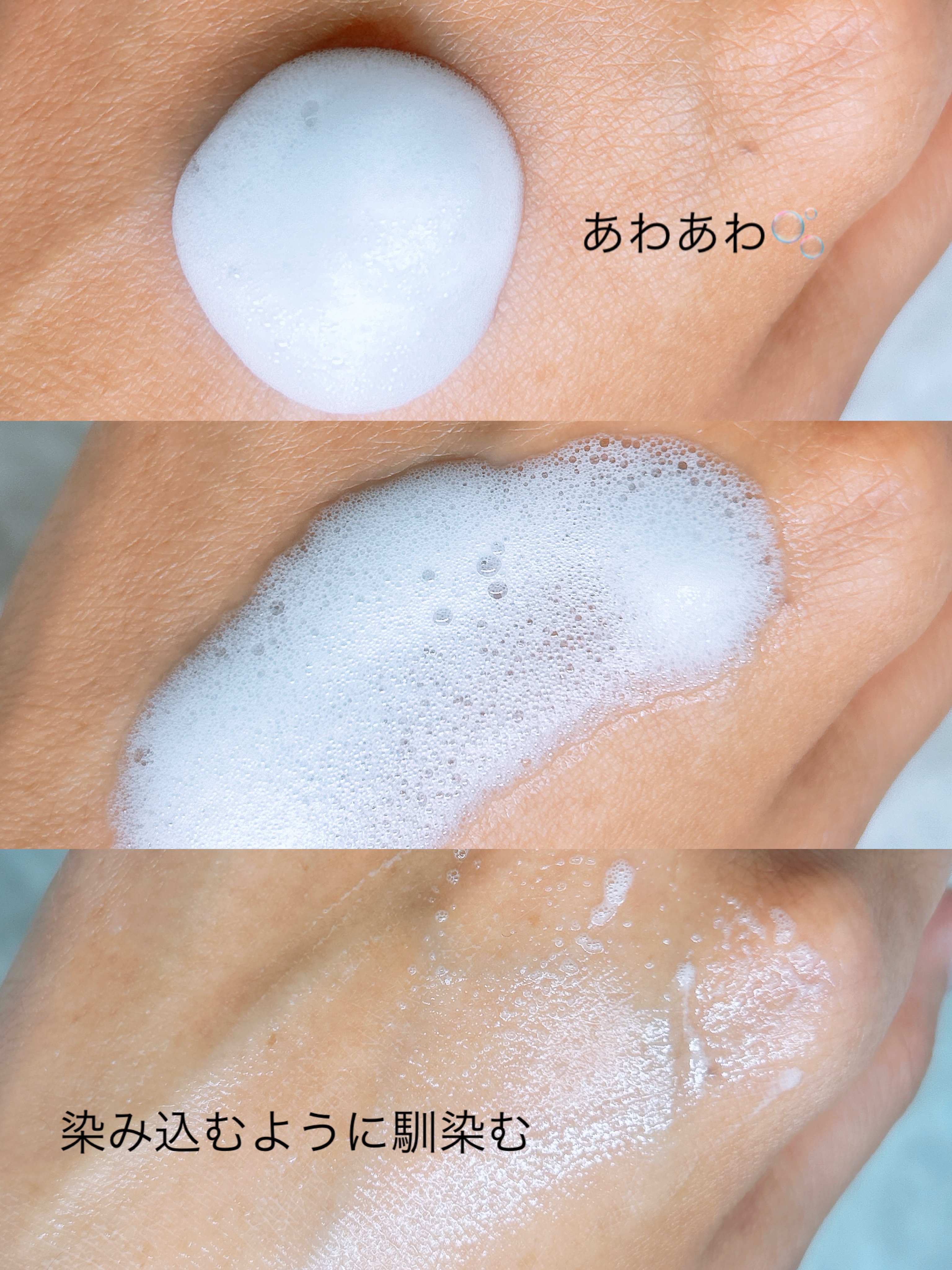 PDRN ヒアルロン酸 ミントマイクロバブルセラム/VT/美容液を使ったクチコミ（3枚目）