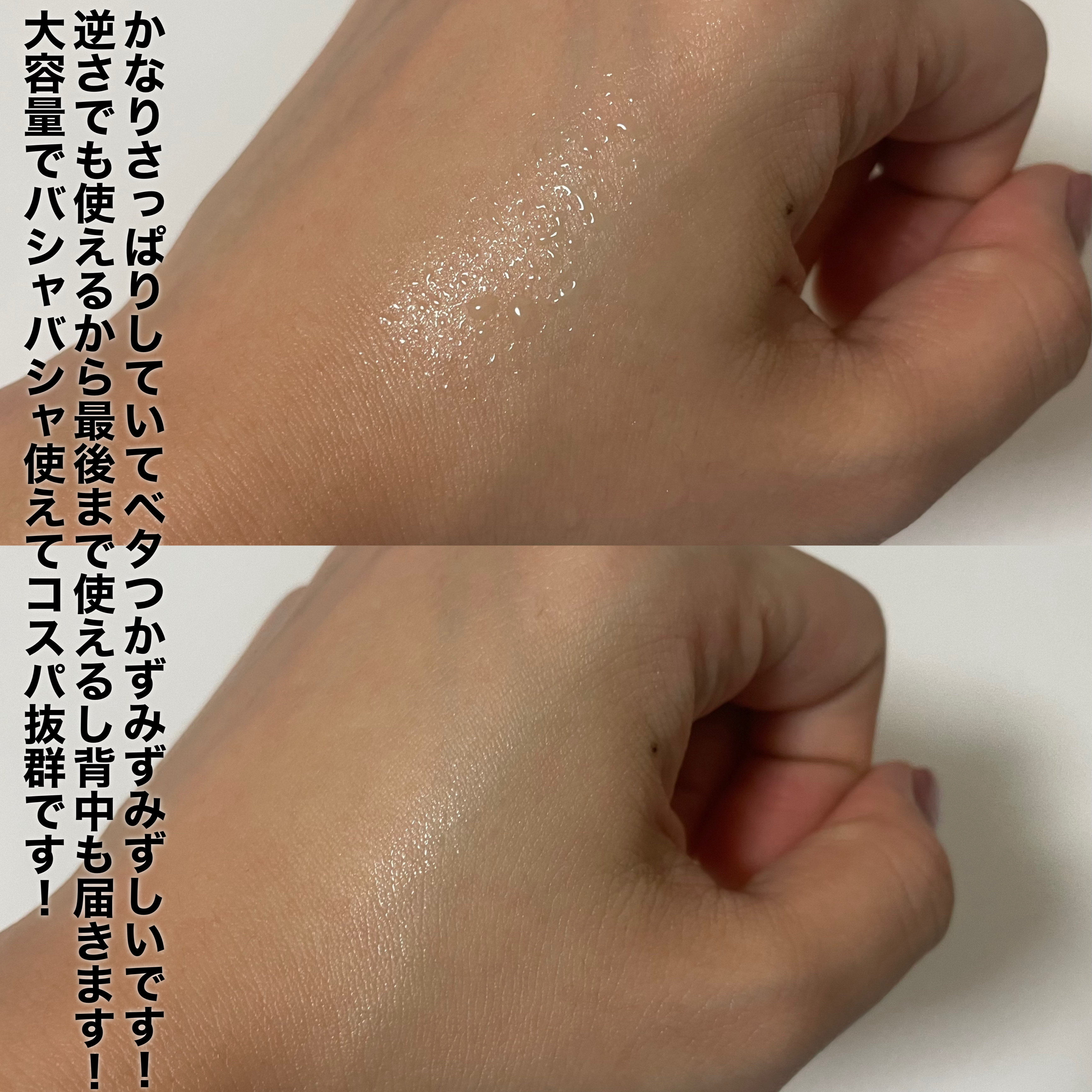 薬用ボディミスト AC/エステニー/ボディローションを使ったクチコミ（3枚目）