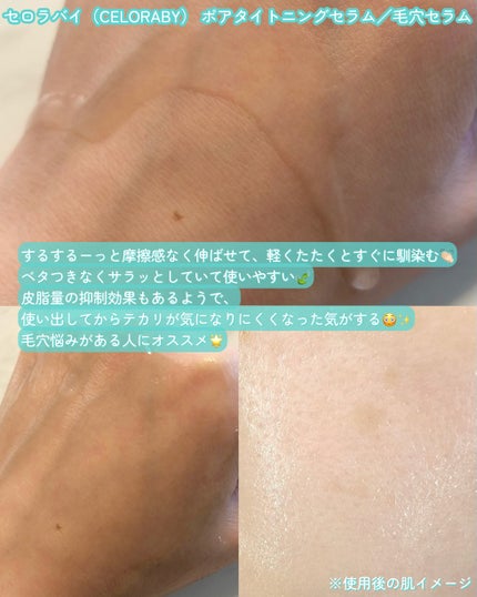 ポアタイトニングブーストセラム/CELORABY/美容液を使ったクチコミ(3枚目)