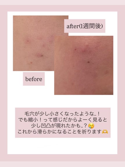 アクアスクワランモイスチャークリーム/S.NATURE/フェイスクリームを使ったクチコミ(4枚目)