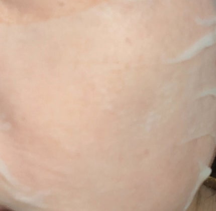 アゼライン酸15 インテンスカーミングセラムインマスク/Anua/シートマスク・パックを使ったクチコミ(4枚目)