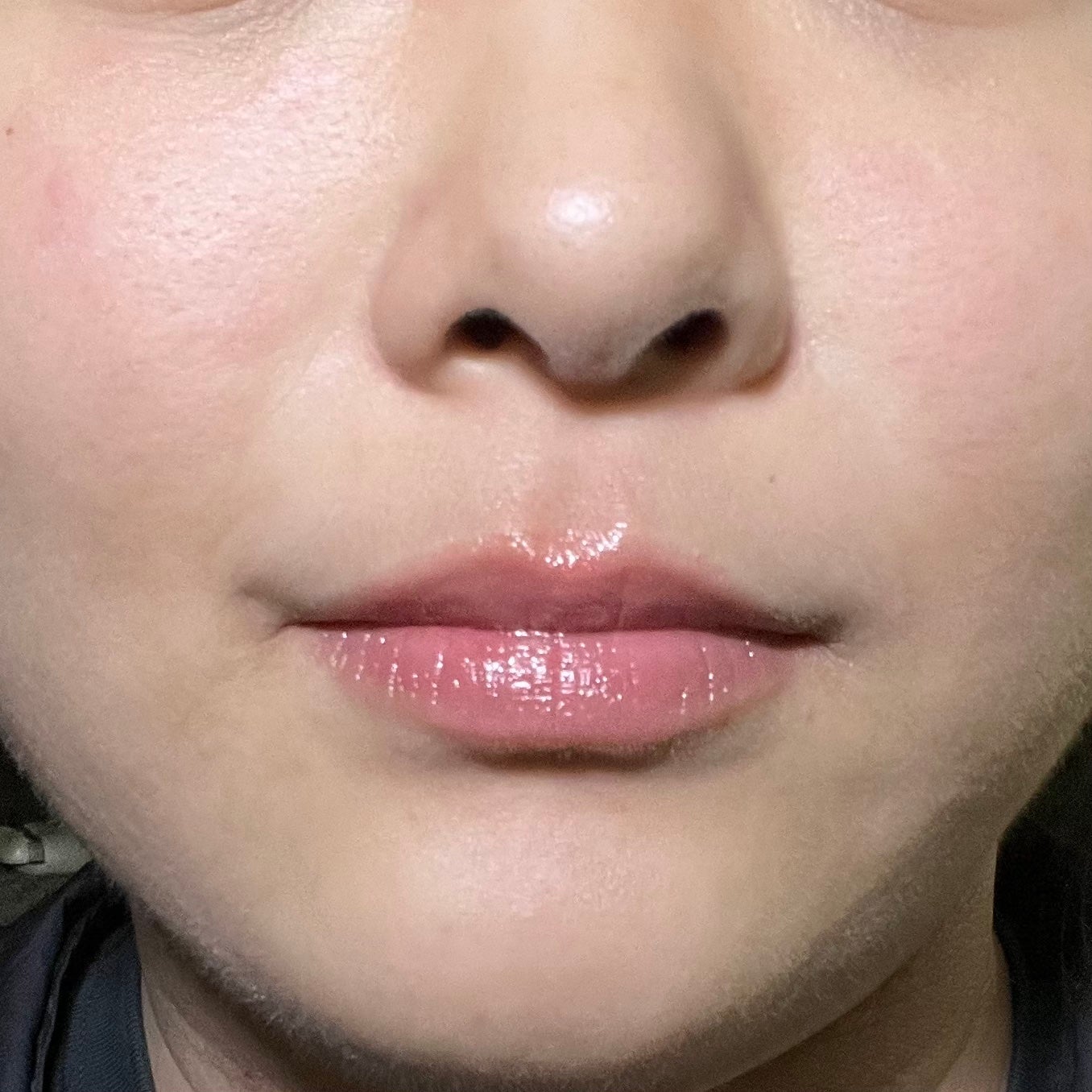 レチノール ボリューム リップセラム(チューブタイプ)/primera/リップグロスを使ったクチコミ(3枚目)