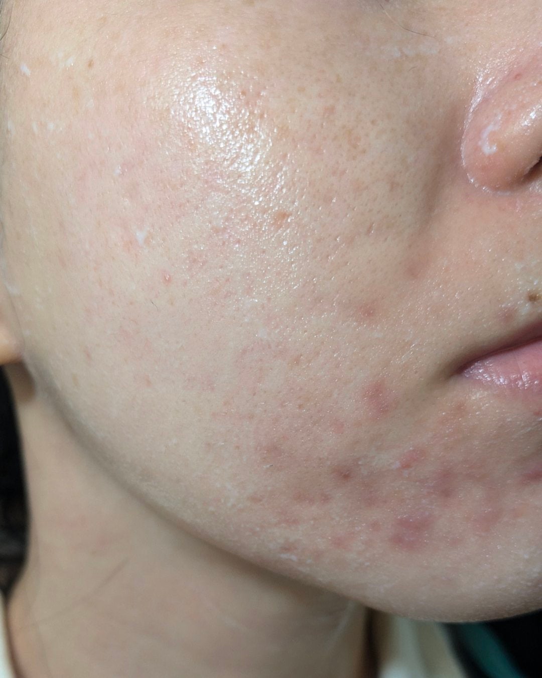 miina@汚肌工事録⚠️ on LIPS 「#汚肌工事録久しぶりに投稿します🙇11月ふりかえり。(11/2..」(1枚目)