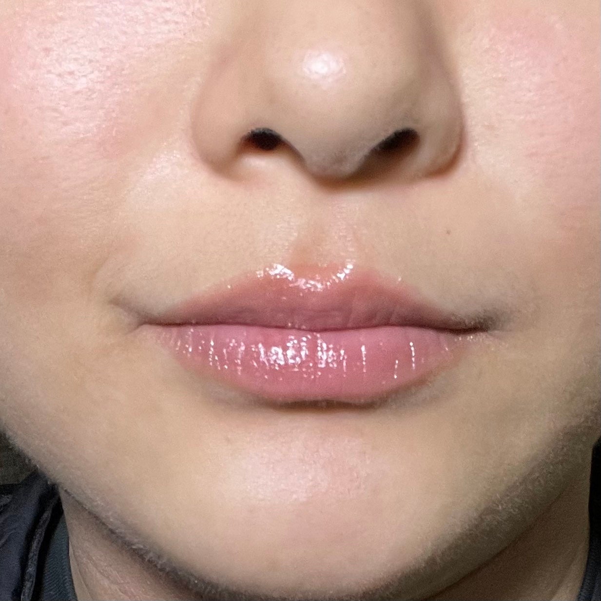 レチノール ボリューム リップセラム(チューブタイプ)/primera/リップグロスを使ったクチコミ(2枚目)