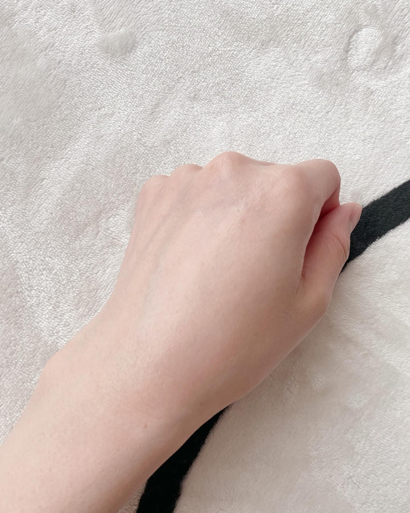 PDRN+リードルS 100/VT/美容液を使ったクチコミ（3枚目）