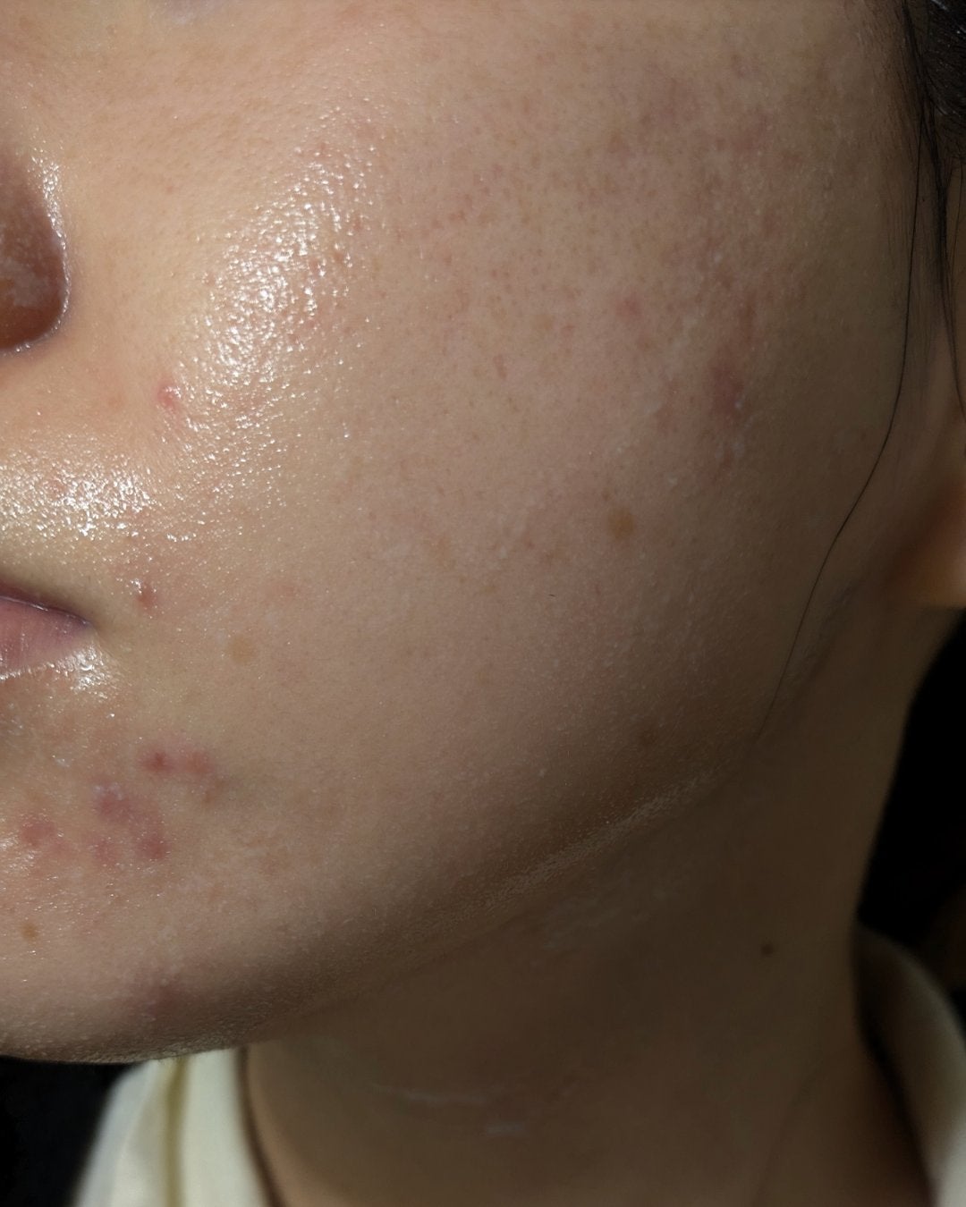 miina@汚肌工事録⚠️ on LIPS 「#汚肌工事録久しぶりに投稿します🙇11月ふりかえり。(11/2..」(2枚目)