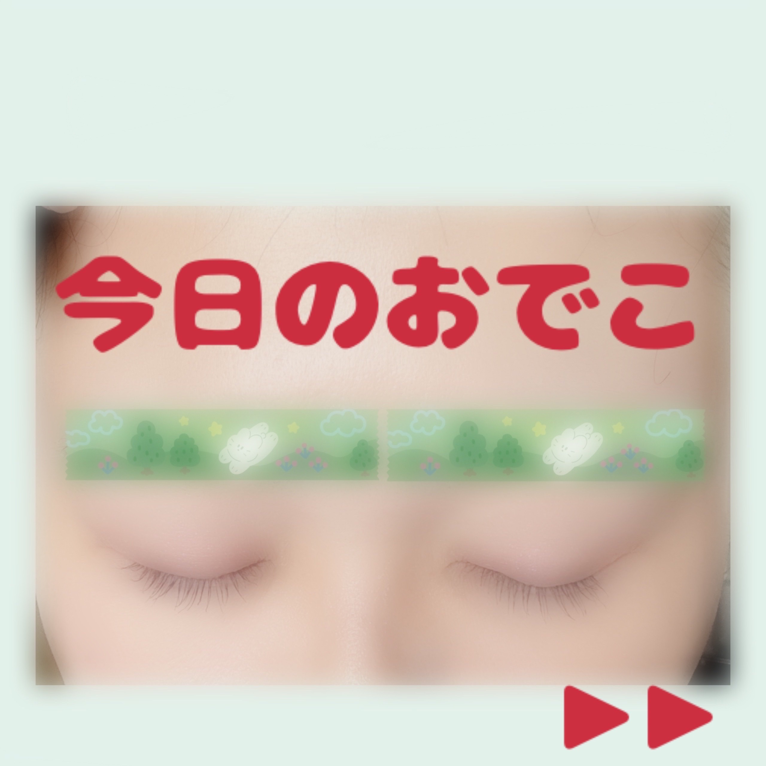 アゼライン酸15 インテンスカーミングセラム/Anua/美容液を使ったクチコミ（1枚目）