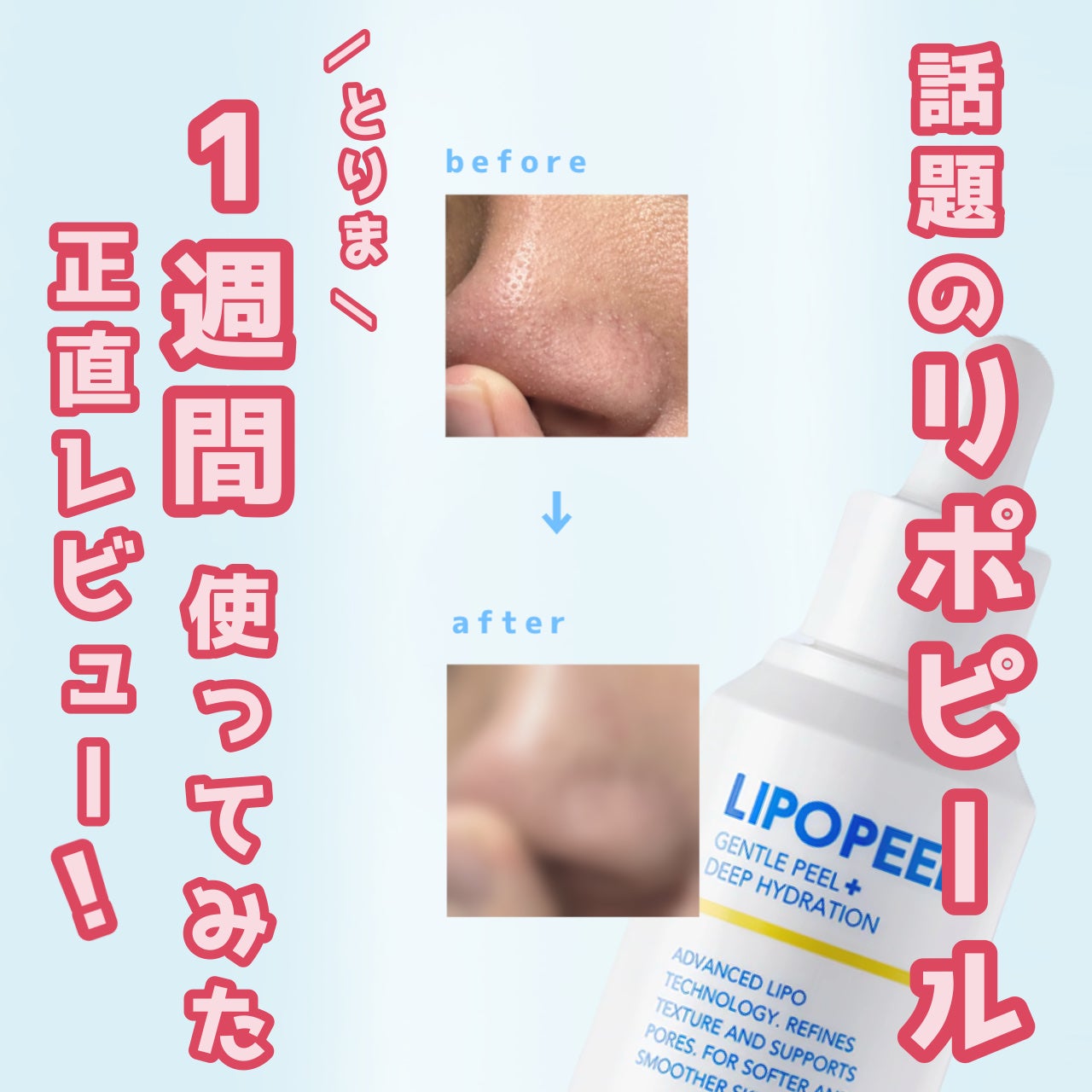 リポピールセラム/LIPOPEEL/美容液を使ったクチコミ(1枚目)