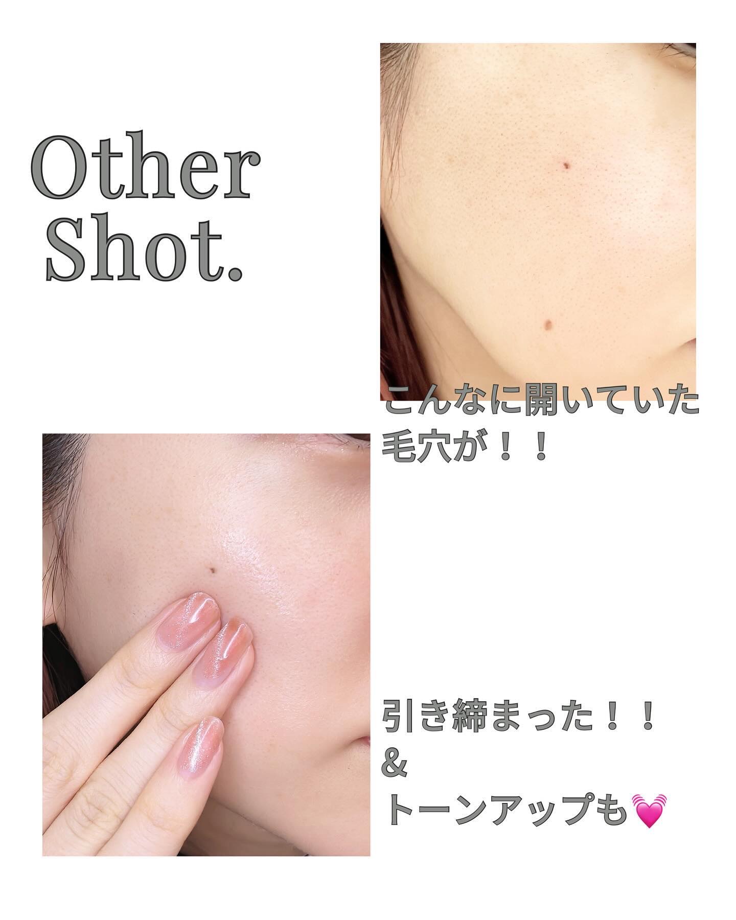 ポアマイジング フラッシュ アンプル/SKIN1004/美容液を使ったクチコミ（3枚目）