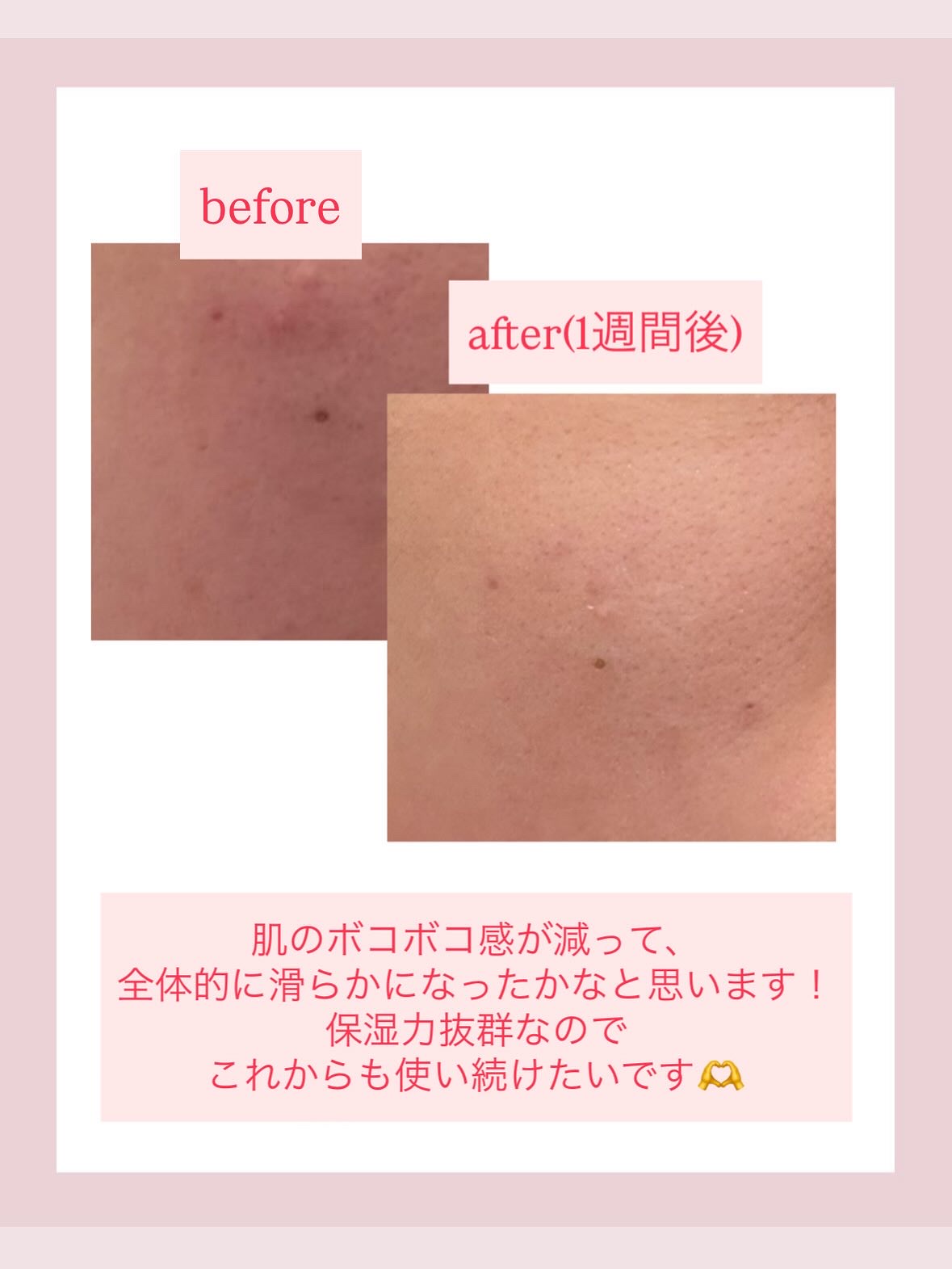 を使ったクチコミ（3枚目）