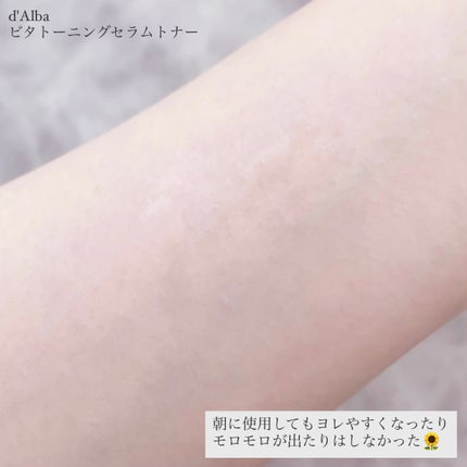 ビタトーニングセラムトナー/ダルバ/化粧水を使ったクチコミ(4枚目)