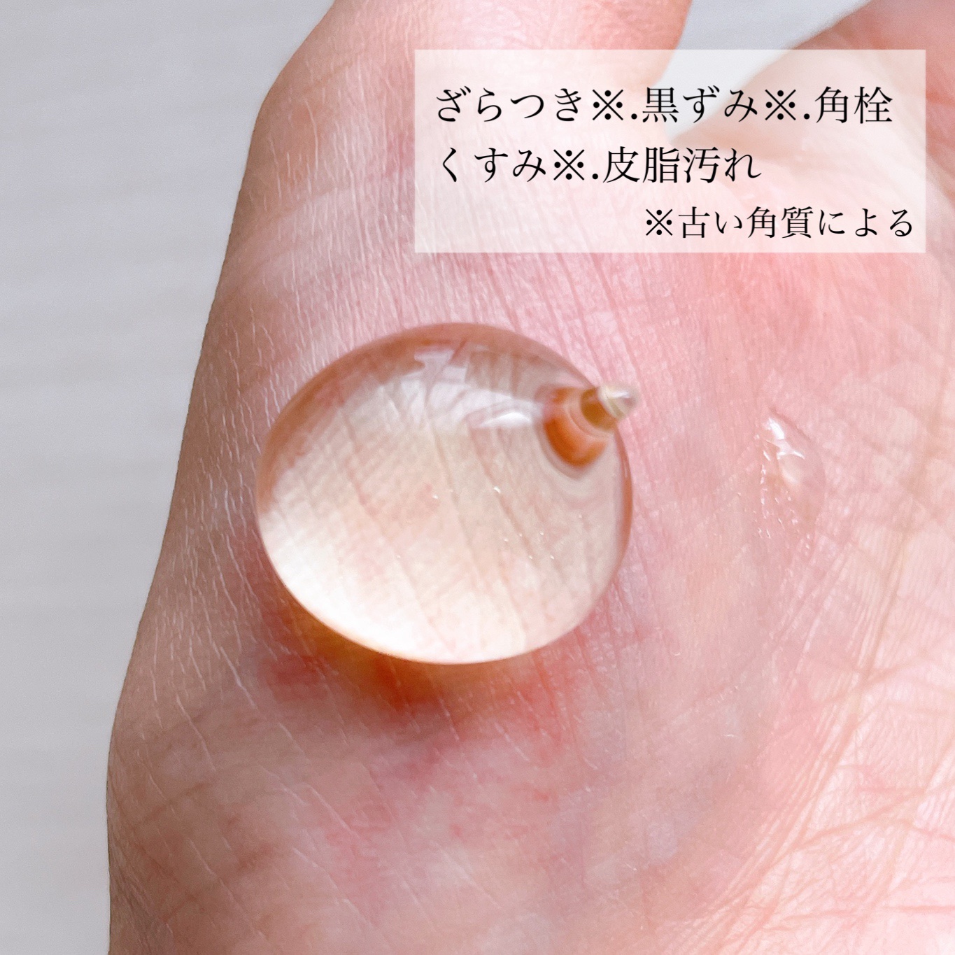 ナチュラルクッションピーリング/アカラン/ピーリングを使ったクチコミ（3枚目）