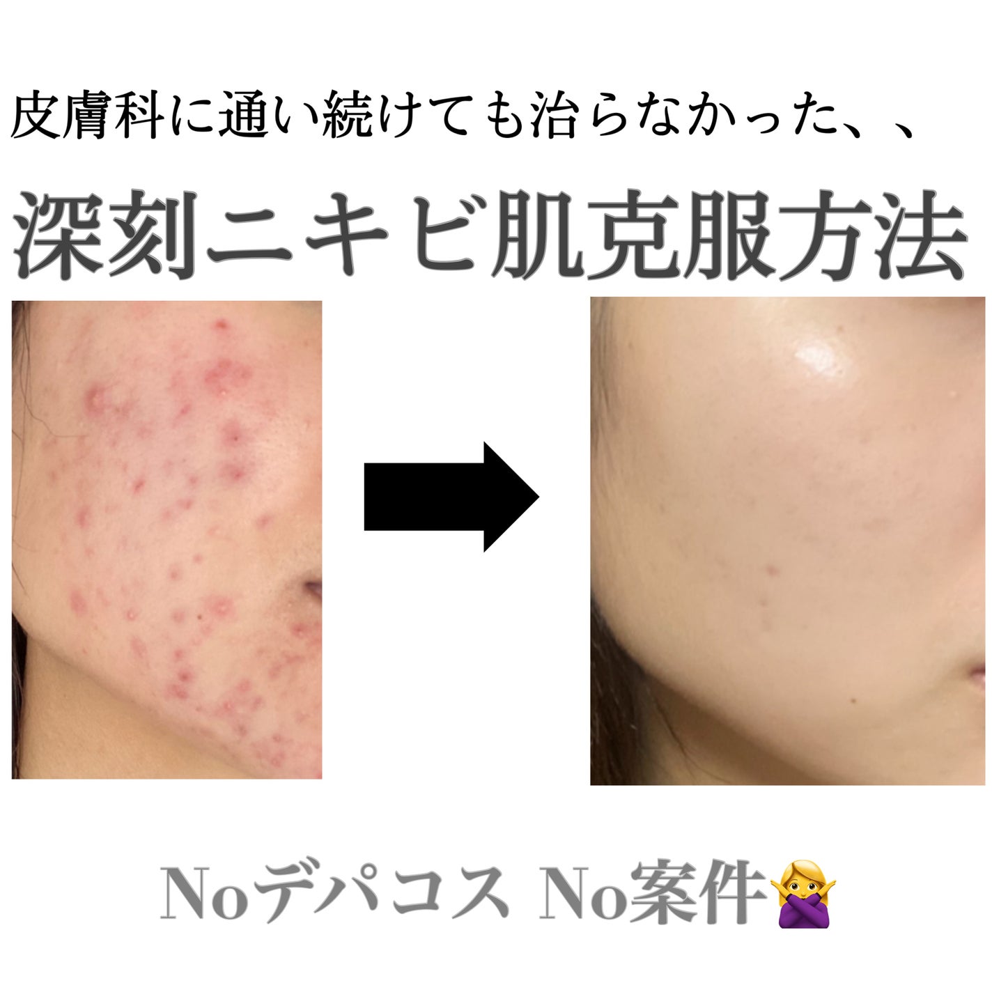 DHC ビタミンBミックス/DHC/美容サプリメントを使ったクチコミ(1枚目)