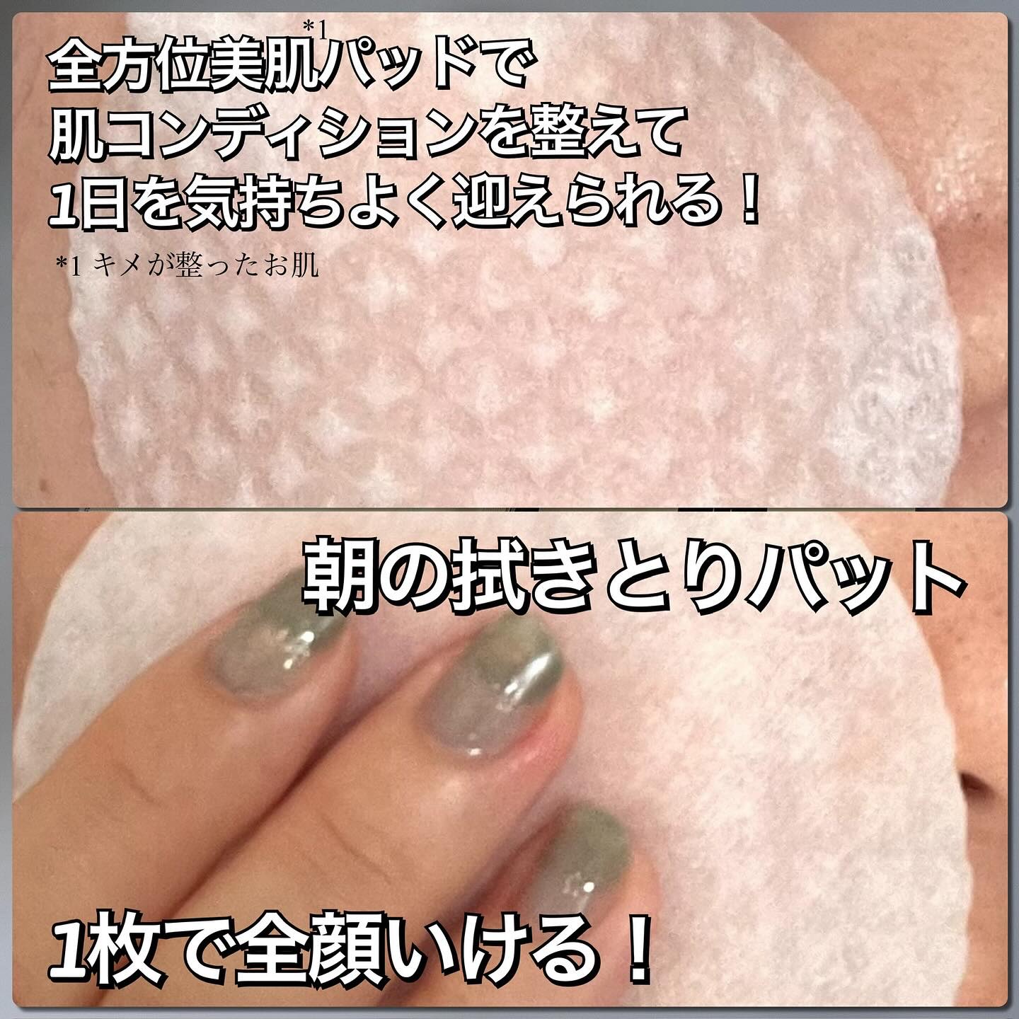 ダーマレーザー ビジョンパッドPRO/クオリティファースト/トナーパッドを使ったクチコミ（2枚目）