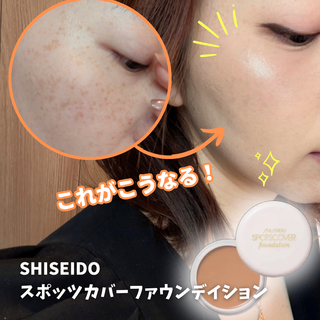 スポッツカバー ファウンデイション/SHISEIDO/クリームコンシーラーを使ったクチコミ（1枚目）