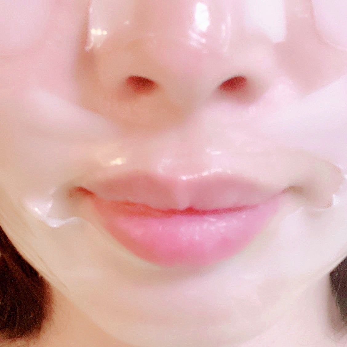 RXザ・アルファアルブチン2 ニキビ跡ケアセラム/COSRX/美容液を使ったクチコミ(10枚目)