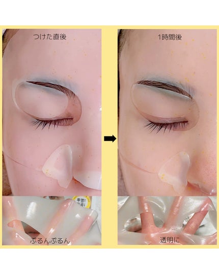 ユース ラディアンス ビタチノール セラム/primera/美容液を使ったクチコミ(5枚目)