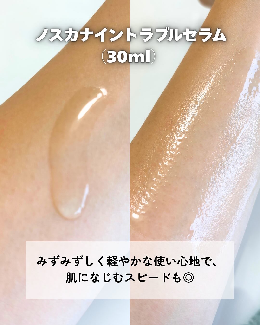 ノスカナイン トラブル セラム/FATION/美容液を使ったクチコミ（3枚目）