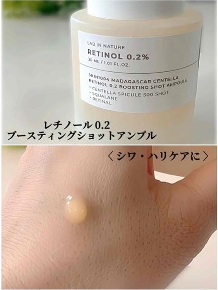 ã¬ãããŒã« 0.2 ããŒã¹ãã£ã³ã°ã·ã§ãã ã¢ã³ãã«/SKIN1004/çŸå®¹æ¶²ã䜿ã£ãã¯ãã³ãïŒ3æç®ïŒ