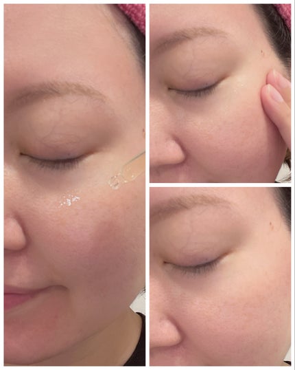 LA10+HAフェイスセラム/The Ordinary/ピーリングを使ったクチコミ(5枚目)