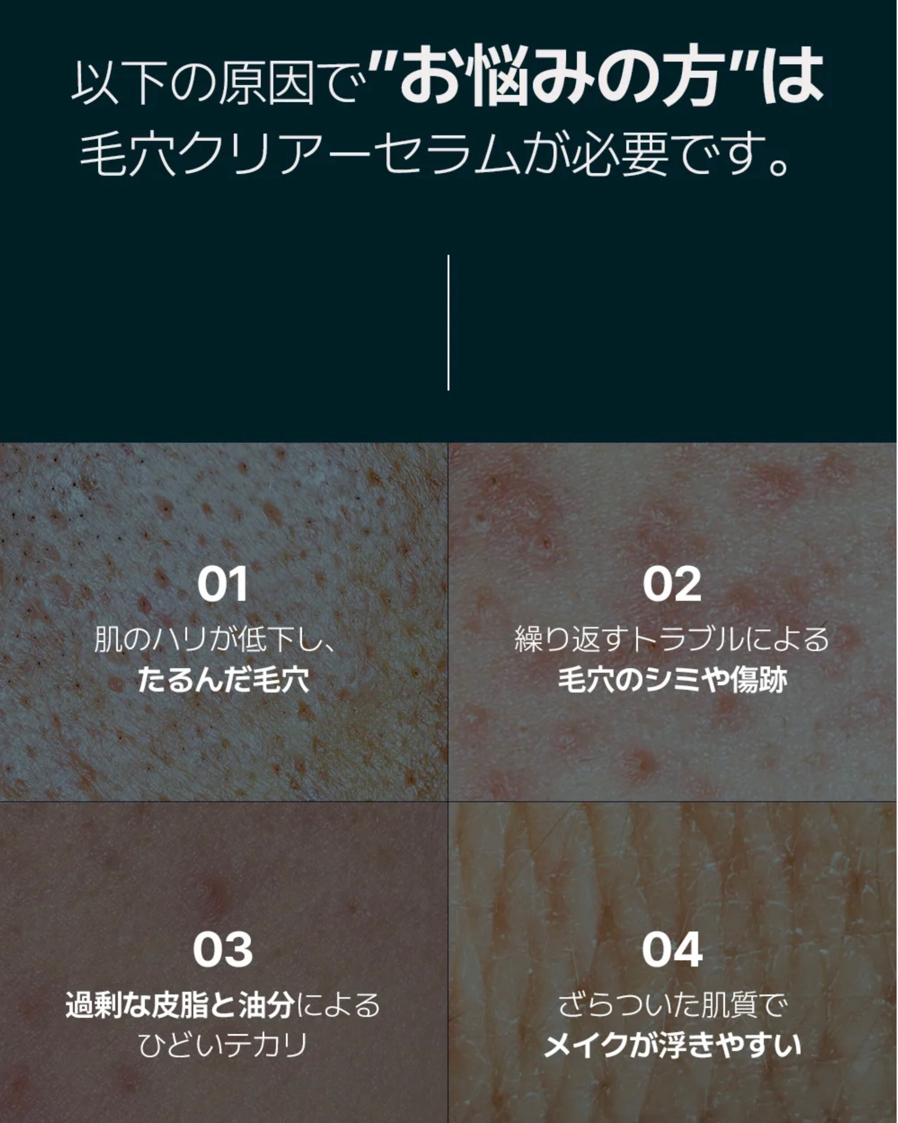 ポアタイトニングブーストセラム/CELORABY/美容液を使ったクチコミ（3枚目）