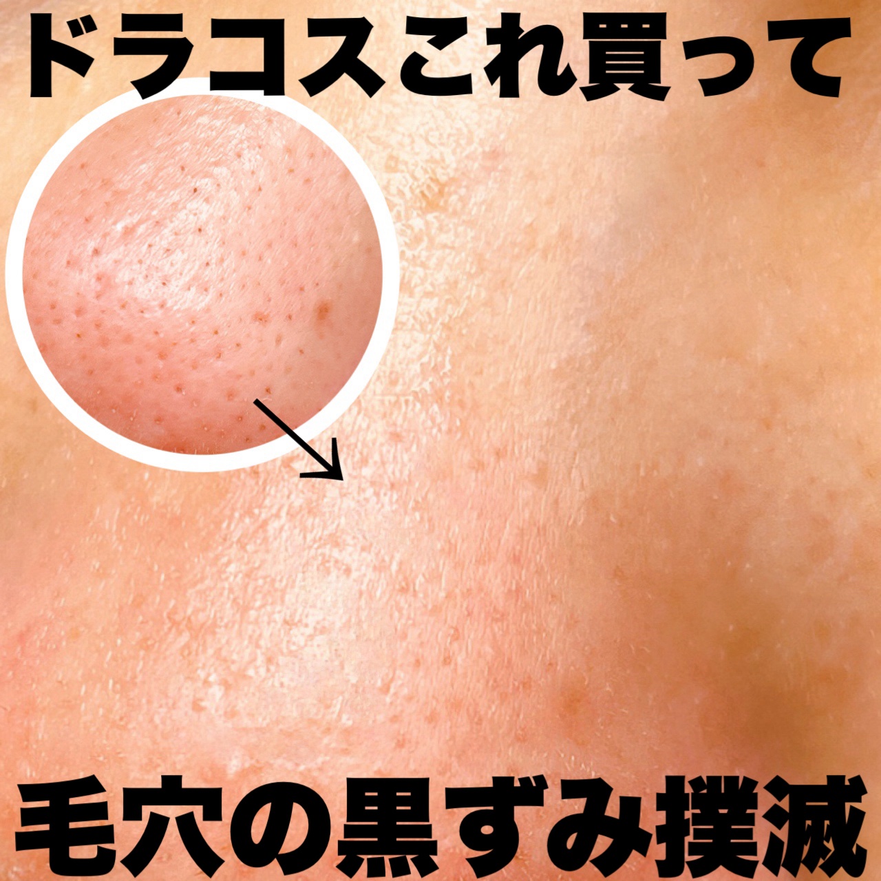 ナチュラルクッションピーリング/アカラン/ピーリングを使ったクチコミ（1枚目）