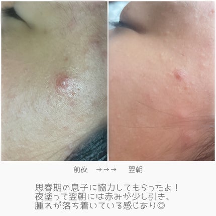 AZケア クレンジングオイル/VT/オイルクレンジングを使ったクチコミ(7枚目)