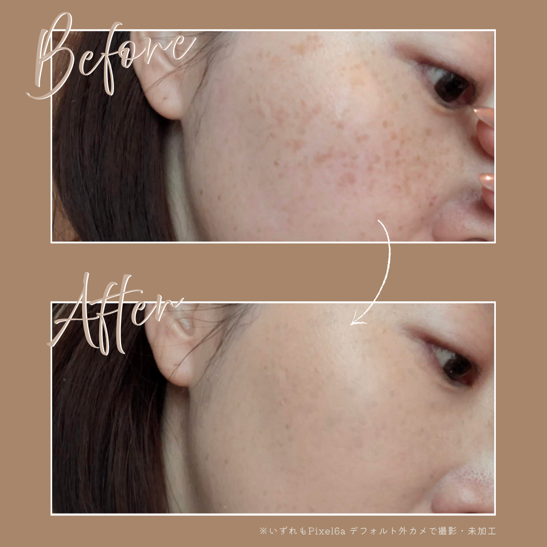 スポッツカバー ファウンデイション/SHISEIDO/クリームコンシーラーを使ったクチコミ（3枚目）