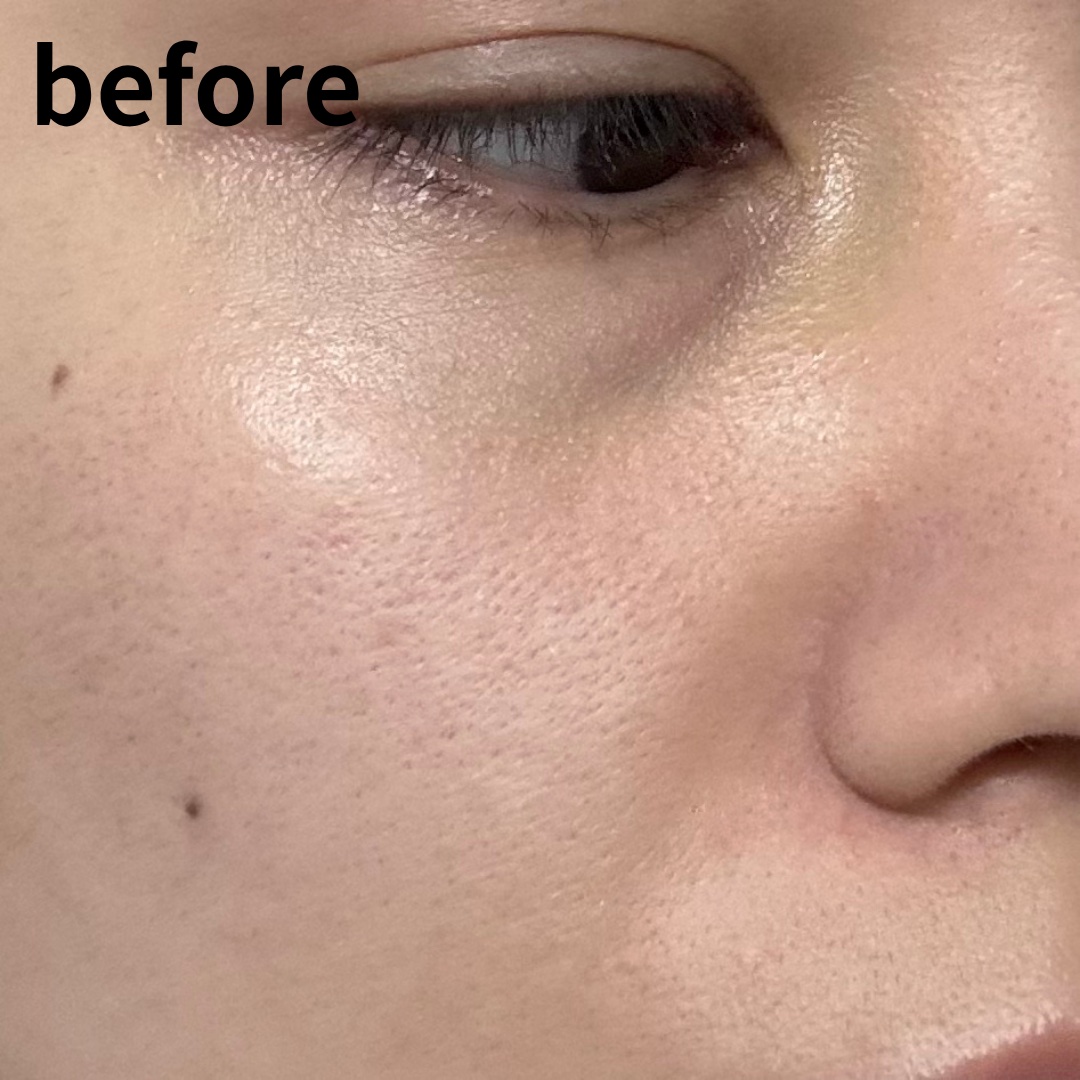 セリエンスナイトセラム/エンビロン/美容液を使ったクチコミ（3枚目）