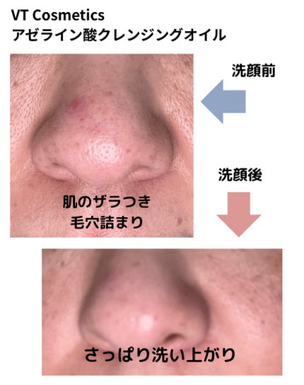 AZケア クレンジングオイル/VT/オイルクレンジングを使ったクチコミ(5枚目)