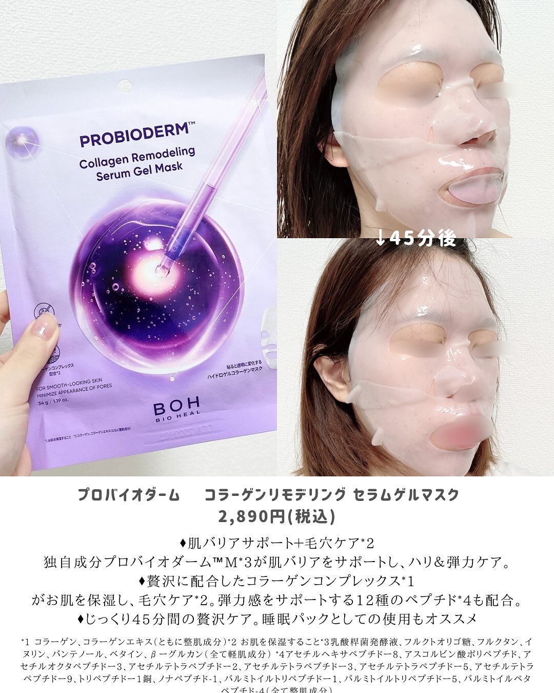 バイオヒールボ プロバイオダーム™ コラーゲンリモデリングゲルマスク/BIOHEAL BOH/シートマスク・パックを使ったクチコミ（3枚目）