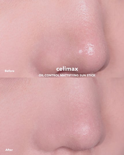 セリマックス クレンジング オイル/celimax/オイルクレンジングを使ったクチコミ(5枚目)