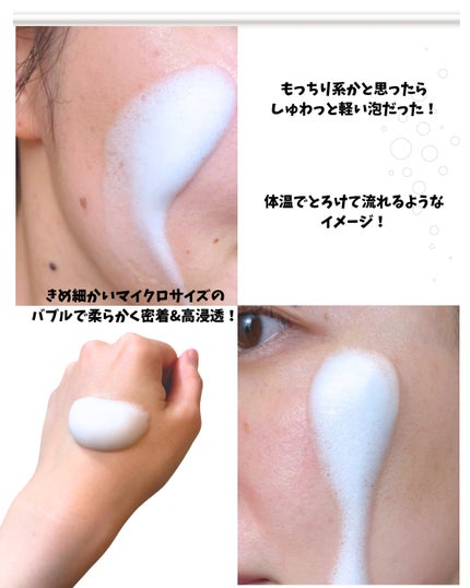 PDRN ヒアルロン酸 ミントマイクロバブルセラム/VT/美容液を使ったクチコミ(5枚目)