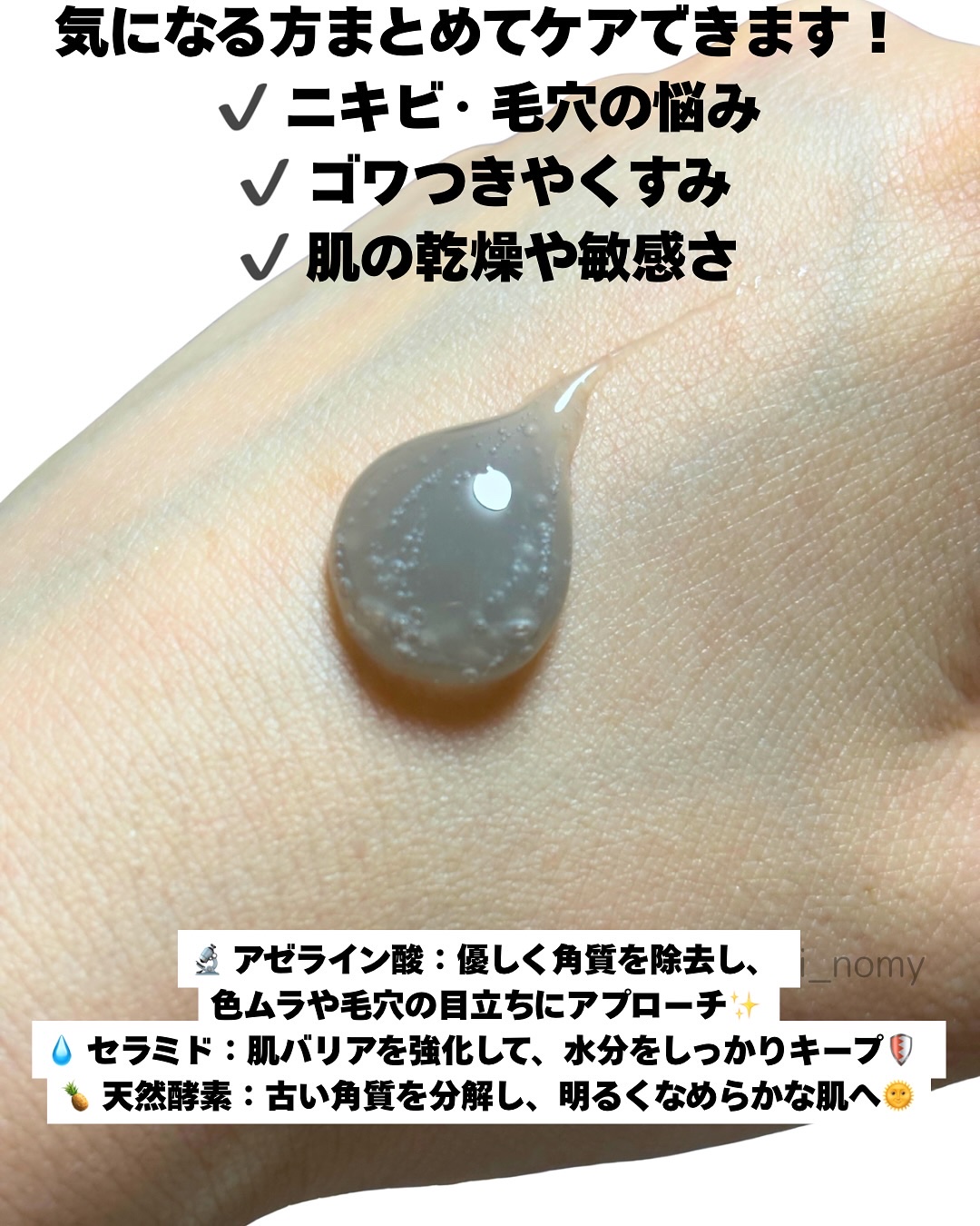 ACE pore cleanser /GREETY/洗顔フォームを使ったクチコミ（3枚目）