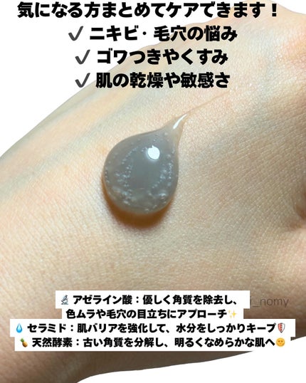 ACE pore cleanser /GREETY/洗顔フォームを使ったクチコミ(3枚目)