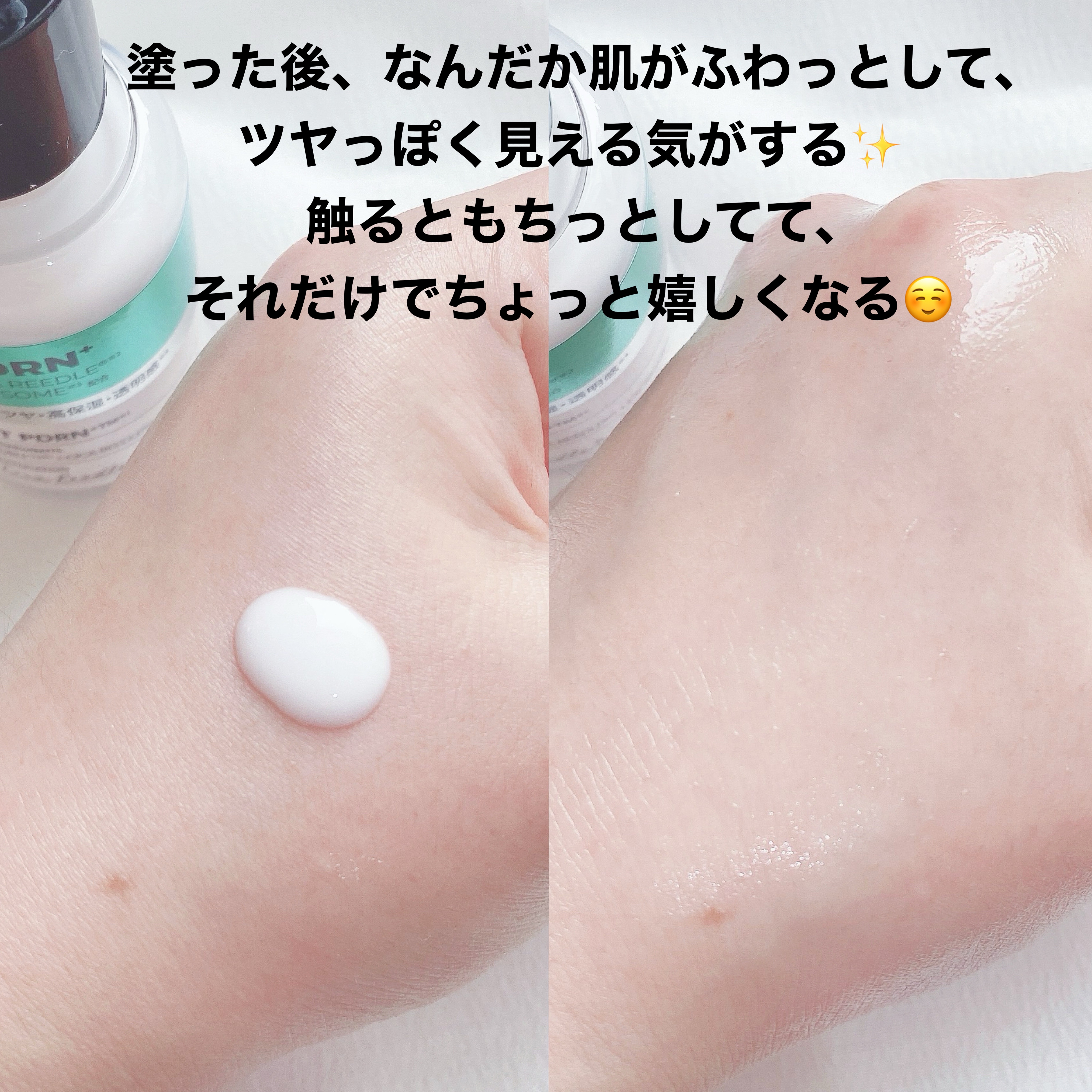 リードルS PDRN+ セラム/VT/美容液を使ったクチコミ（2枚目）