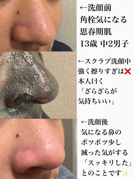 ディズム スクラブクリームウォッシュ ブラック/DISM/洗顔フォームを使ったクチコミ(6枚目)