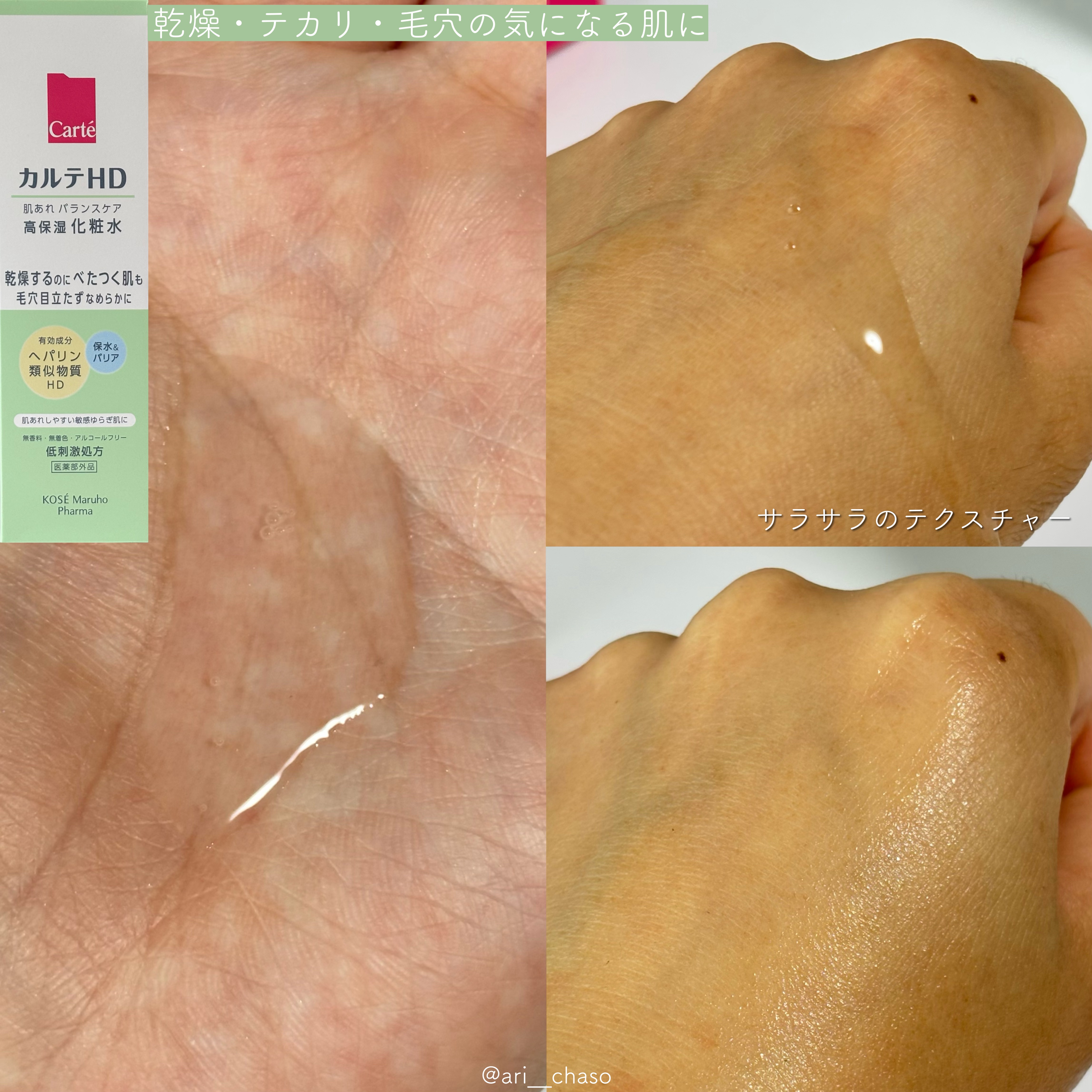 モイスチュア ローション/カルテHD/化粧水を使ったクチコミ（3枚目）