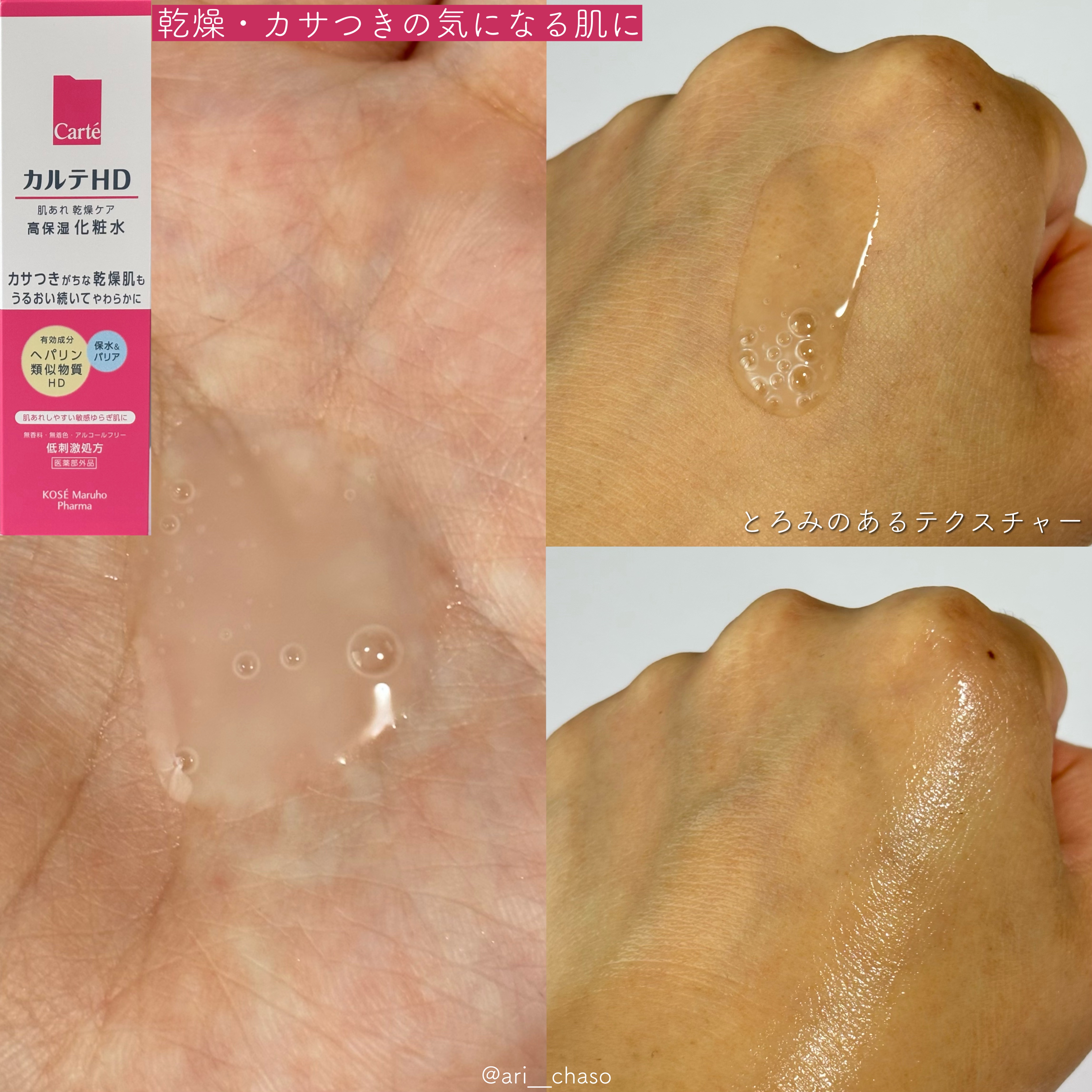 モイスチュア ローション/カルテHD/化粧水を使ったクチコミ（2枚目）